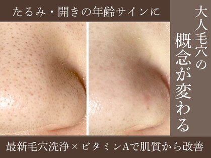 ラウン 京都(ROUN’)の写真