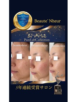 ボーテヌール(Beaute Nheur)の写真/『肌改善5年連続受賞サロン』肌改善のプロが行う施術