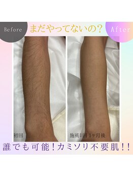 エミュ(emu)/メンズ腕