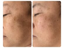 プルーラントエステ ヒメジ(Pullulant Esthe Himeji)/クリスティーナ・ローズドメーラ