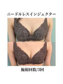 サラ/ニードルレスインジェクター