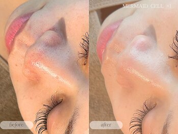 フォンビューティー(fon beauty)