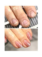 ネイル キシミー(Nail-Kishimi)/深爪で指先を見られたくない