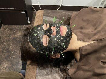 ロミハリ(LomiHari)/顔パック付き美容鍼