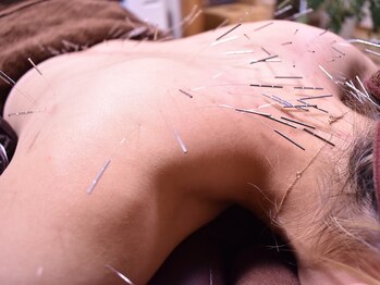 鍼屋フミ(鍼屋FUMI)