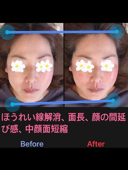 美容矯正サロン レレポノ(LELEPONO)/