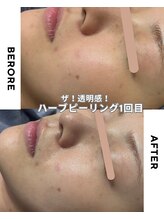 ブロッサム(Blossom)/