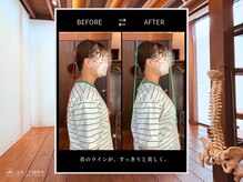 ユルノテ 国分寺/ビフォーアフター3