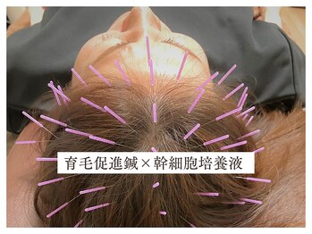 リアン(Re-Ane)の写真/20年以上の経験をもとに、お一人おひとりの体質や不調の原因を丁寧に分析。
