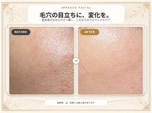 インプローヴフェイシャルカンコクキキフェイシャルサロン(IMPROVE Facial)
