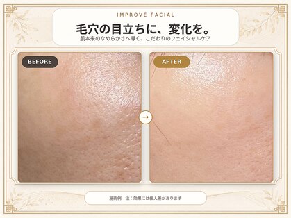 インプローヴフェイシャルカンコクキキフェイシャルサロン(IMPROVE Facial)の写真