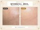 インプローヴフェイシャルカンコクキキフェイシャルサロン(IMPROVE Facial)の写真