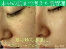 マールム(MALUM)