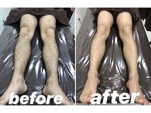 メンズカラー 成田店(Calla)/ワックス脱毛