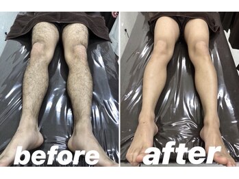 メンズカラー 成田店(Calla)/ワックス脱毛