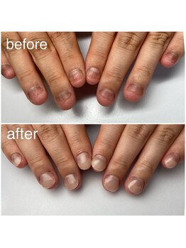 パスリー ネイルアンドケア(Parsley Nail&Care)/深爪補修