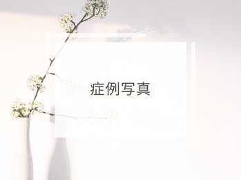 リボーン(Reborn)/症例写真