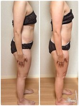 ヨサパーク スマイル(YOSA PARK SMILE)/効果事例