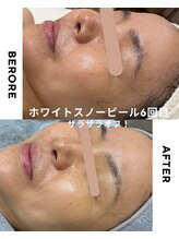 ブロッサム(Blossom)/