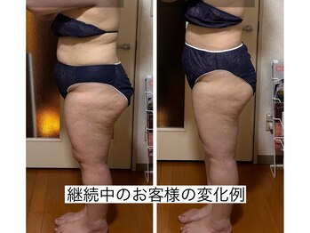 ヨサパーク エクラエム(YOSAPARK eclat.emu)/継続中のお客様の変化
