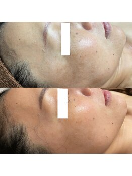 ナチュレ(Nature)/２週間に１度のスペシャルケア