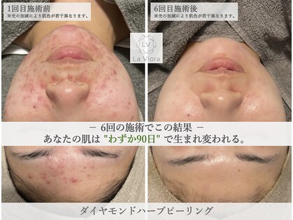 ラヴィオーラ 福島野田店(La Viora)の写真