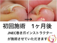 アモネイル バイ プライベートサロン(amonaiL by privatesalon)の雰囲気（巻き爪陥入爪トラブル爪対応しております！ご相談ください☆）