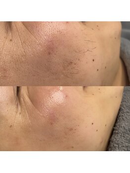 ソワン(Soin)/メンズも美肌の時代