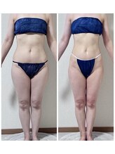 キュール(KuhL)/45歳2か月-4ｋｇ