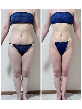 キュール(KuhL)/45歳2か月-4ｋｇ