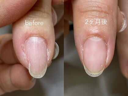 ニーヨンゼロ(240)の写真