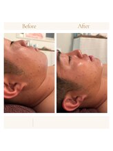 ビューティーサロンレモン(Lemon)/