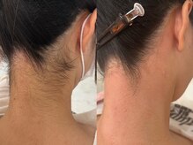 リュンヌ 津店(LUNE)/うなじWax