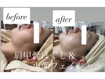 リシェカ(Richeka)/小顔フェイシャル