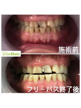 ルブラン 奈良店(Le Blanc)/使い方！通い方は自由！