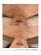 ピーロ ルレ(salon Piilo Rule)の写真/【ほうれい線、たるみ改善!予防ケア】「最近なんか違う」 そのままにしていませんか?