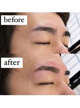 サムライビューティー 西新宿本店(SamuraiBeauty)/眉毛施術 Before l After