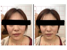 田端整体院/小顔効果が顕著！