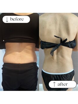 トータルビューティーサロンリア(Li'a)/ビフォー＆アフター