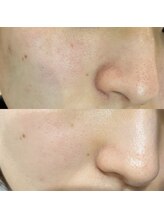 ナーススキン(nurse skin)/ビフォーアフター5