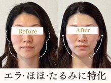 サロンキャン(Salon.CAN)