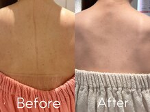 カレンジェビューティー(CarengeBeauty)/プラチナクレイピールBody