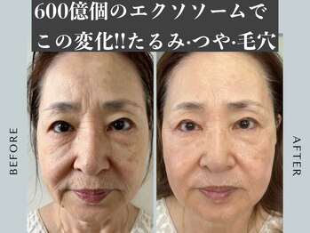 サロン ド エヌ(Salon de N)