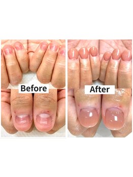 爪の悩みを解消できる（ケア含む）