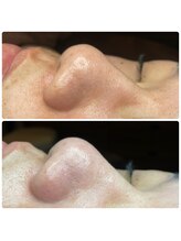 フェリーチェ(felice)/