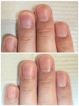 ミモザ(mimosa)/お爪の周りのお手入れ