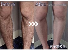 サロン ド プリエ(Salon de Plie)/夏に向けて今からでも間に合う！