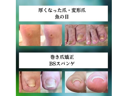 ポドウオーク(PODO WALK)の写真