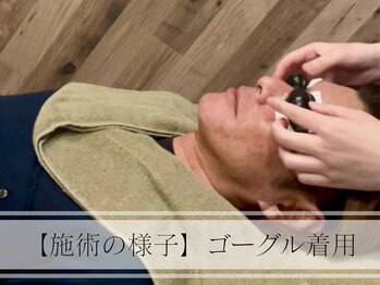 メンズプラス(MEN’S PLUS)/ヒゲ脱毛/施術風景