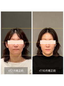 プライミー(PRIMY)/衝撃の変化